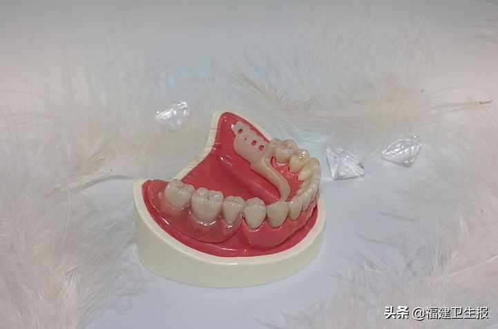 大爷误吞假牙8天后就医,大爷误吞假牙视频