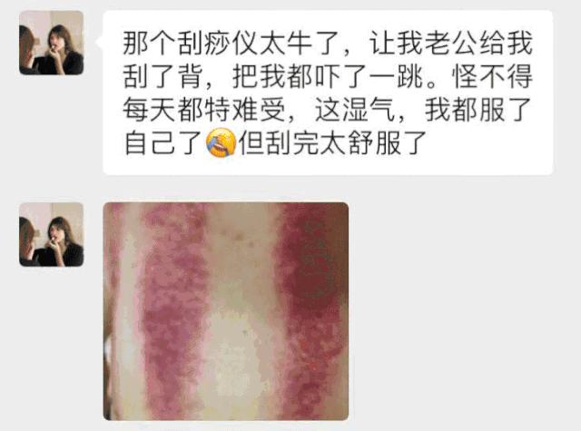 电动刮痧拔罐仪能随便拔罐吗,电动刮痧拔罐仪排毒