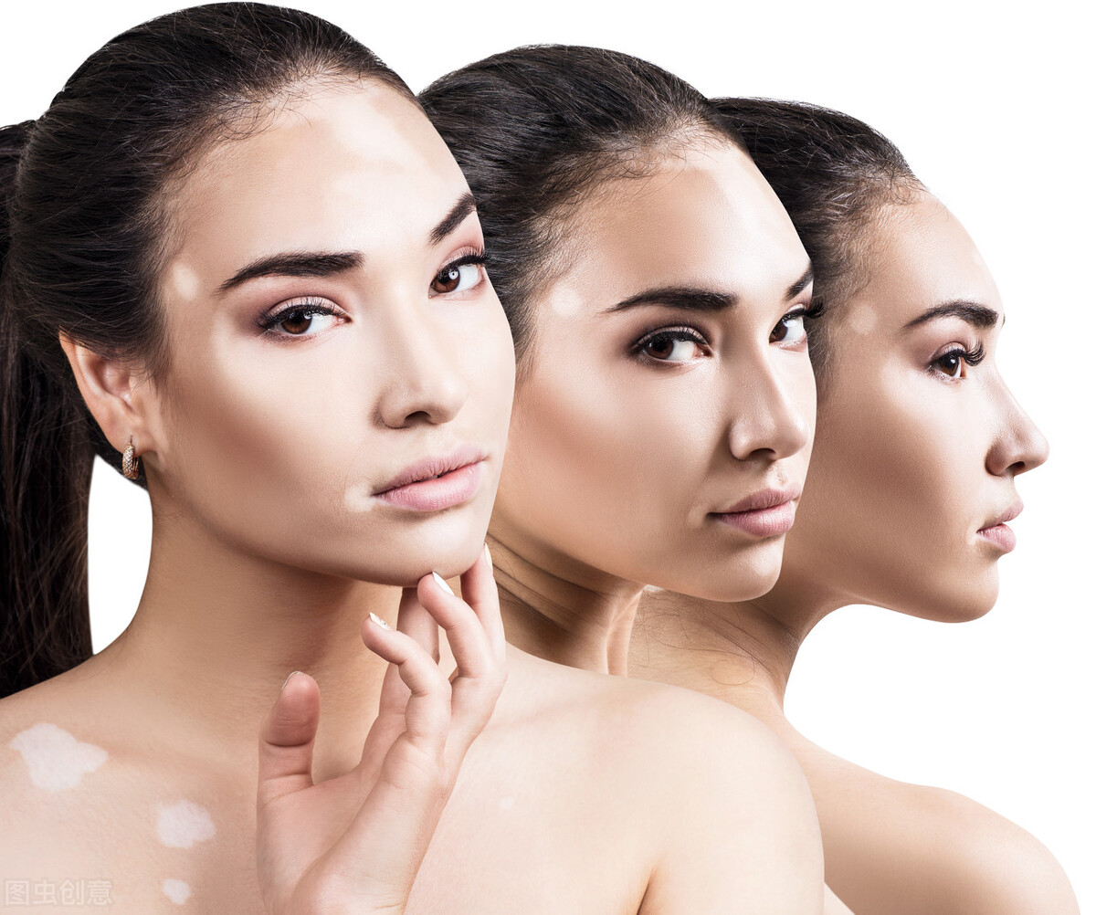 白癜风用手捏会变红吗,白癜风用手搓会变红视频