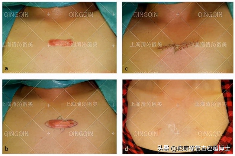 涓嶅繕鍒濆績鐮ョ牶鍓嶈鍖犲績绛戞ⅵ,涓嶅繕鍒濆績鍖犲績绛戞ⅵ