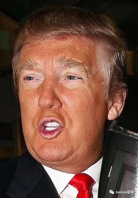 为什么老特的眼袋是白色的？