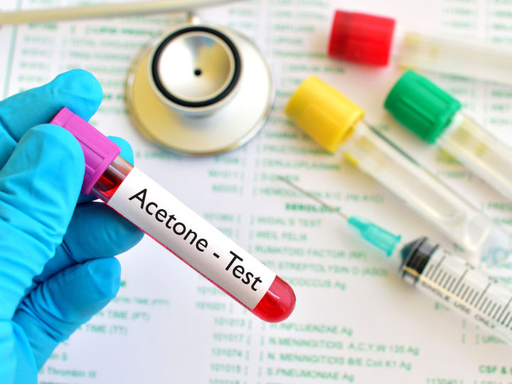 糖尿病并发酮症酸中毒是什么病,1型糖尿病并发症酮症酸中毒