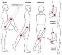 股骨头坏死和腰间盘突出症状区别,椎间盘突出和股骨头坏死症状区别