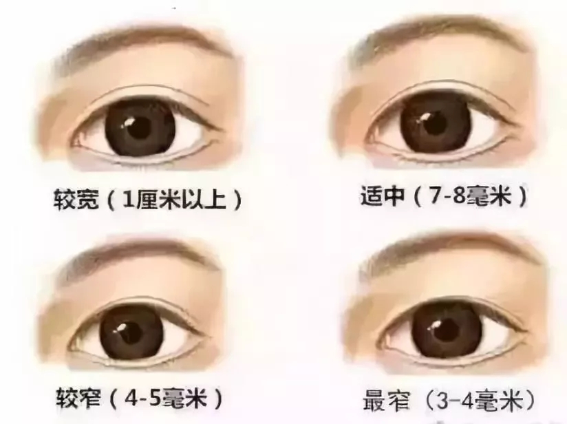 整形为什么一定要去医院面诊，才能报出具体价格？