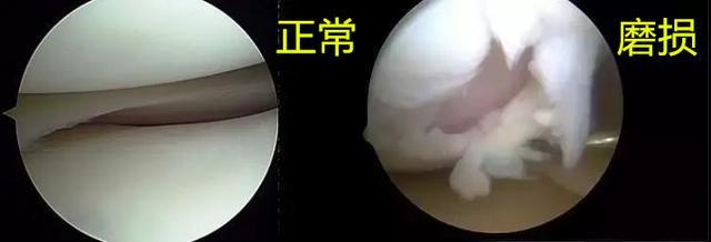 关节炎前期的症状和治疗方法,关节炎基础与临床