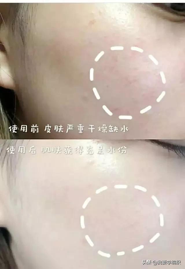 冬天脸干,连皱纹都出来了?日本女博士教你一招,抹几下白白嫩嫩