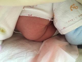 宝宝红屁股是因为纸尿裤质量吗,宝宝红屁股是不是没弄干净啊