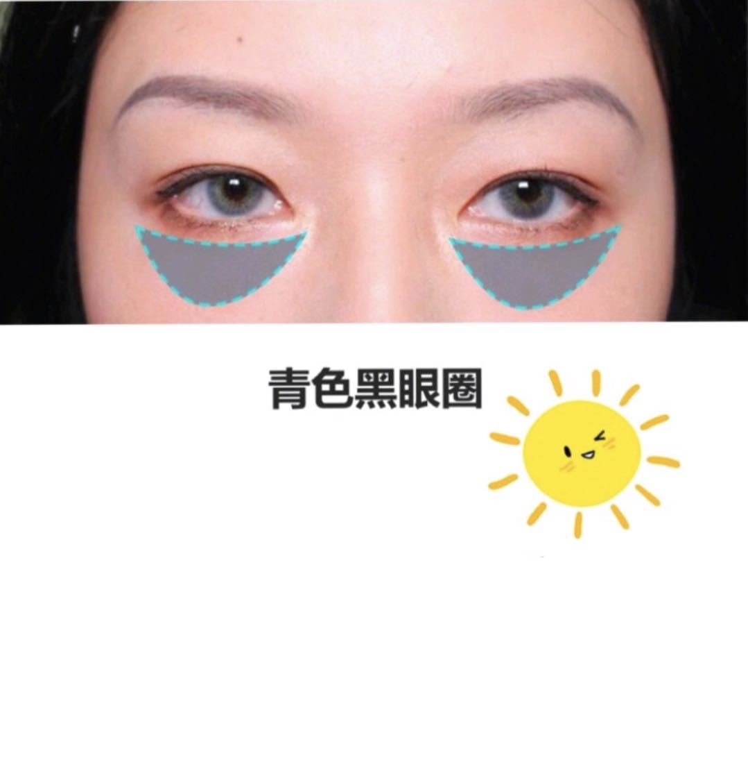 用了很多眼霜还是有黑眼圈？别怪产品太鸡肋，只能说是你没选对