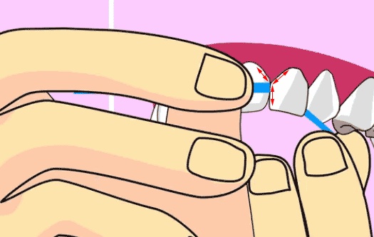 牙上的黑点能刷牙刷掉吗,每天坚持刷牙黑点会消失吗