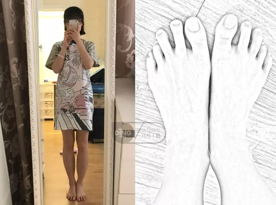 小腿粗穿什么款的鞋子好看,帮你选鞋