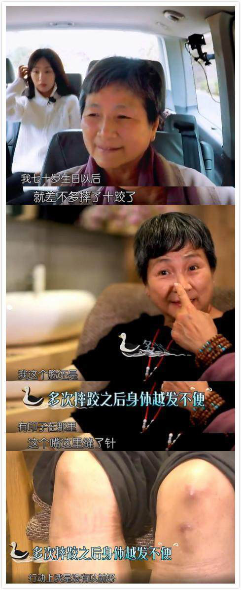 老人家摔了进icu的存活率,摔倒了住进icu了