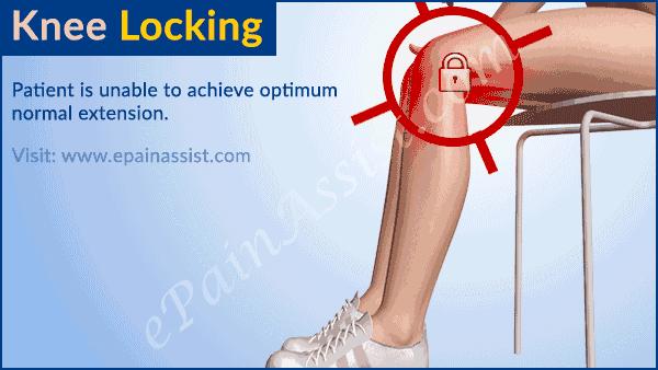 半月板损伤的成因和预防策略,关于半月板损伤的临床表现及诊断