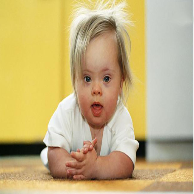 为什么大龄孕妇会容易生唐氏儿,妈妈怀了唐氏儿的孩子怎么办