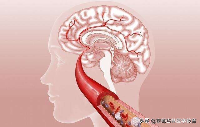 执业医师考试脑部疾病,执业医师考试诊断学考点