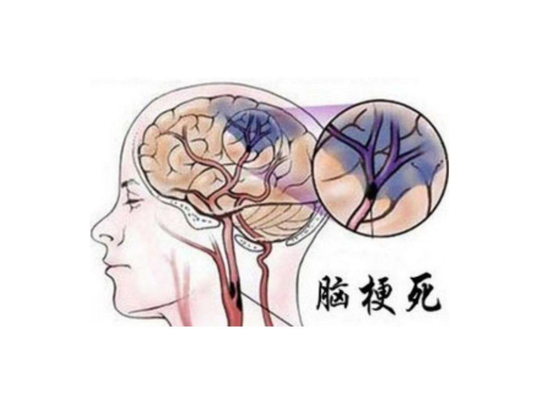 糖尿病牢记这3种食物,糖尿病饭后1小时不能做这4件事
