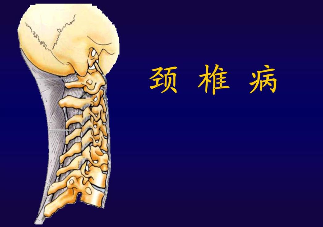 脖子一扭咔咔响老是不舒服怎么办,颈椎病脖子一动咔咔响是什么原因