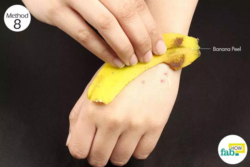 蚊子咬了用什么药膏止痒最快,蚊子咬了用什么药膏止痒快