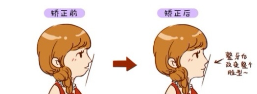 牙齿歪七扭八大小不一能矫正吗,牙齿歪90度是怎么整过来的