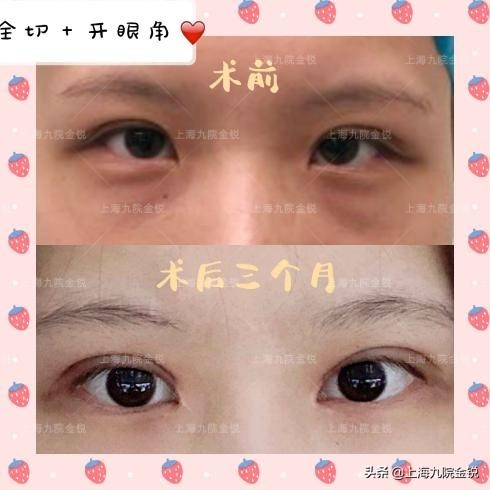 双眼皮VS单眼皮，为什么更多人喜欢双眼皮？