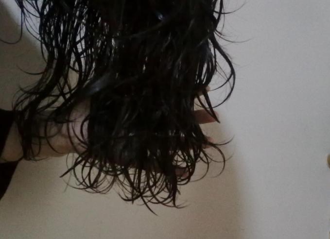 头皮总是长疙瘩或脓包是什么原因,为啥头皮总是长疙瘩