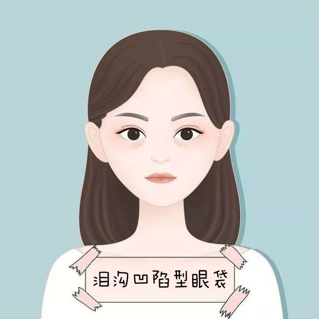 别让眼袋泪沟耽误你的美丽,不要让眼袋影响了你的颜值