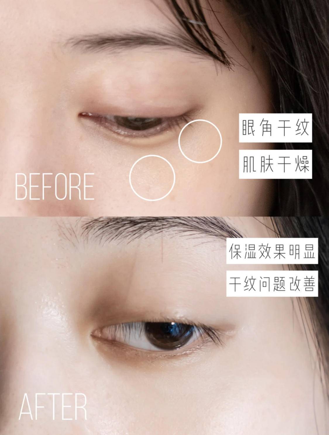 保湿眼霜推荐10款,18岁天生黑眼圈眼袋眼霜推荐平价