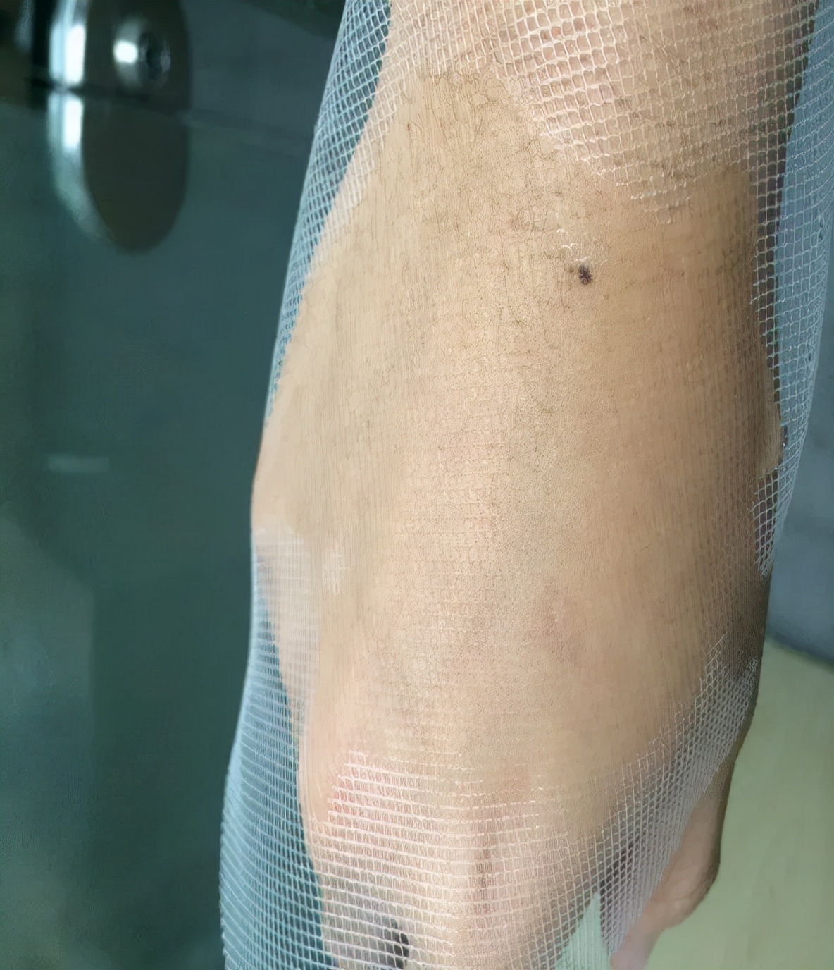 妇科盆底康复案例分享,女性盆底重建手术最好的医生