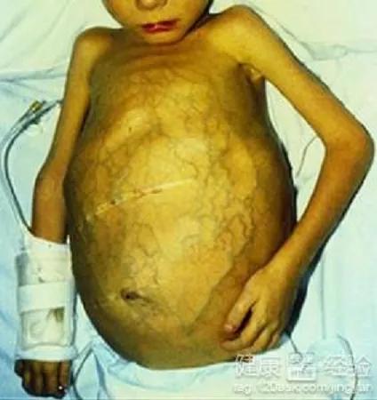 身上长了红色的蜘蛛点怎么回事,身上有蜘蛛红点