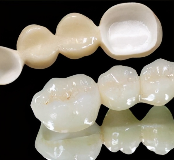 二氧化锆烤瓷牙进口和国产区别,二氧化锆烤瓷门牙缺点