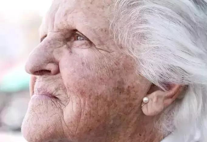 起底老年斑！98岁秦怡为何仍光彩照人？皮肤科主任透露老年人真正护脸“神器”