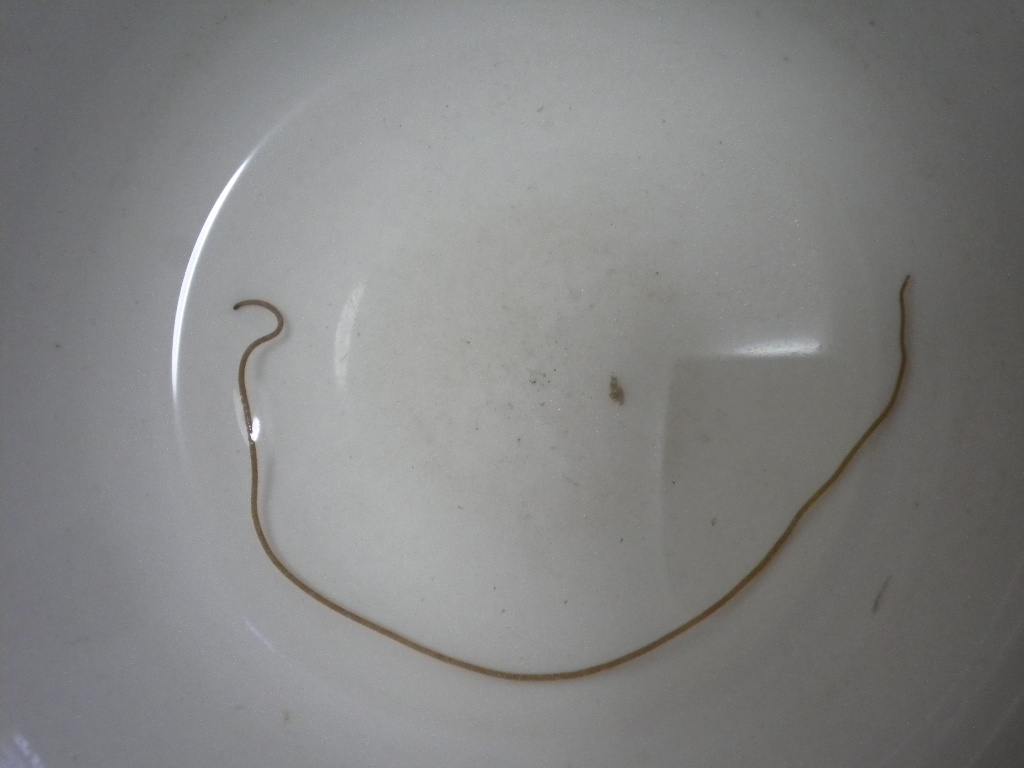 鱼类体外寄生虫有哪些,鱼类寄生虫会寄生人类吗