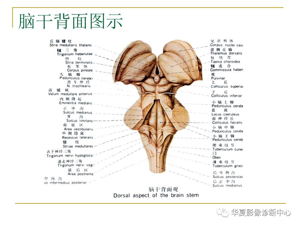 中国人脑立体定向mri应用解剖图谱,脑mri示意图