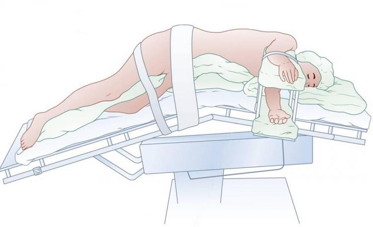 肺癌术后肺功能的康复,肺癌术后tsgf