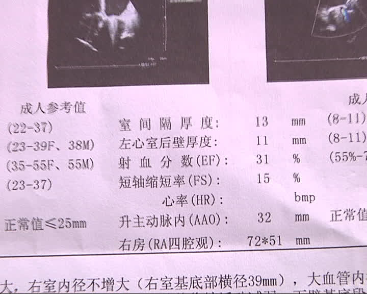 化验血收费1500元正常吗,查个血检验费1000多