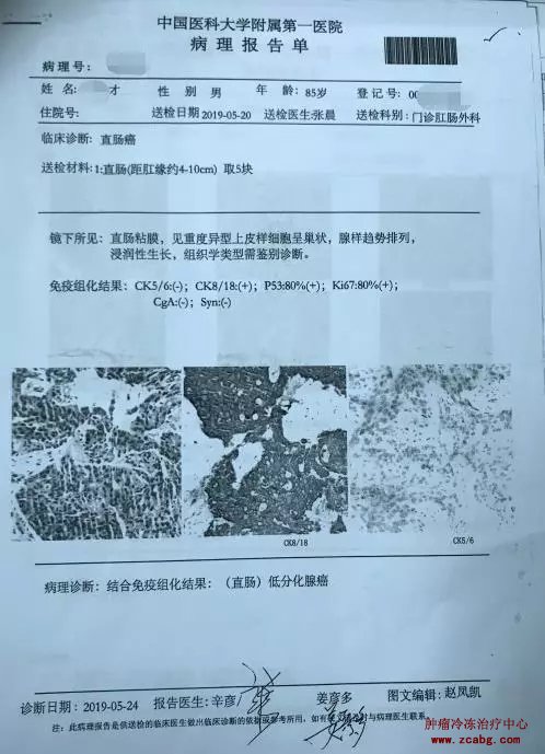 对于低位直肠癌患者，除了改道、放疗、化疗还有其他办法吗