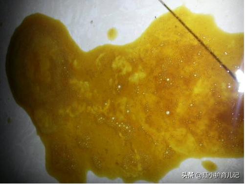 刚出生6天婴幼儿排便应该多少次,育儿避坑指南