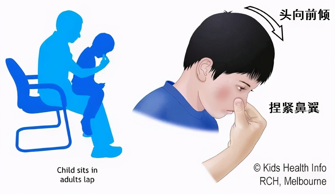 宝宝鼻粘膜脆弱流鼻血怎么办,宝宝鼻子塞流鼻涕最快解决方法