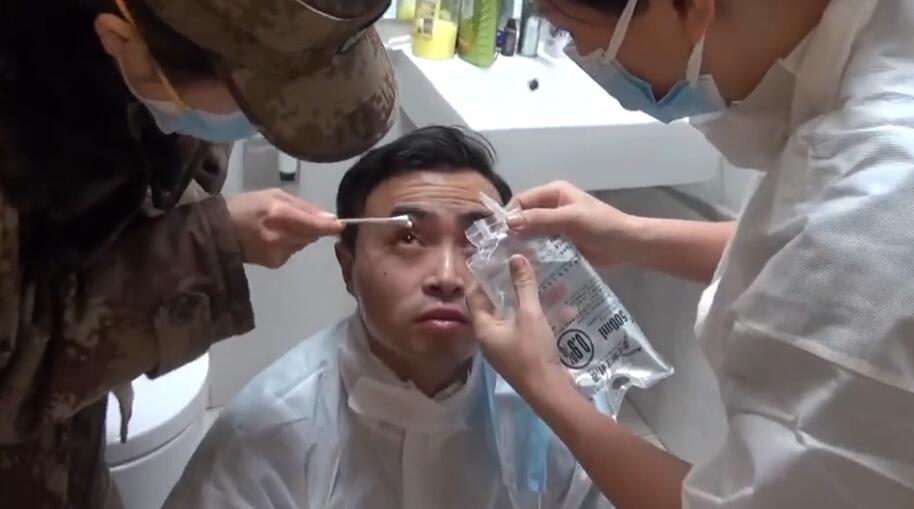 眼皮被502胶水粘住教你一招解除,湖南8岁男孩眼睛被502胶粘住