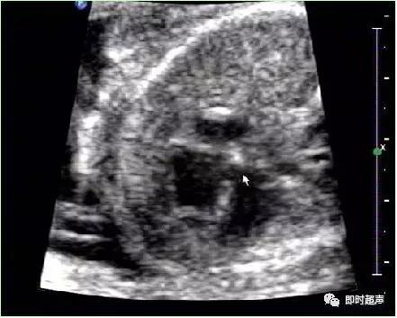 产科常规彩色超声报告单介绍,常见妇科疾病超声报告