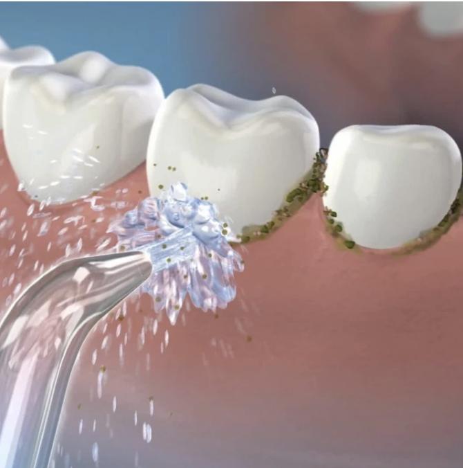 有了电动牙刷还要买便携冲牙器？洁碧、飞利浦，Oclean对比