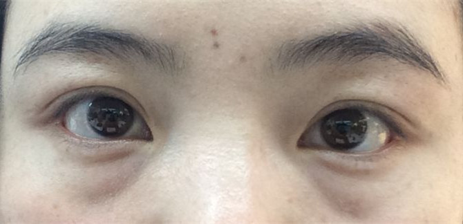 什么眼霜最好用去眼纹,眼部用什么眼霜比较好