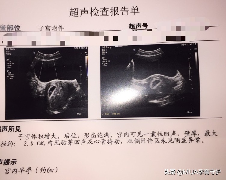 如何确认自己是否怀孕,如何简单快速判断是否怀孕