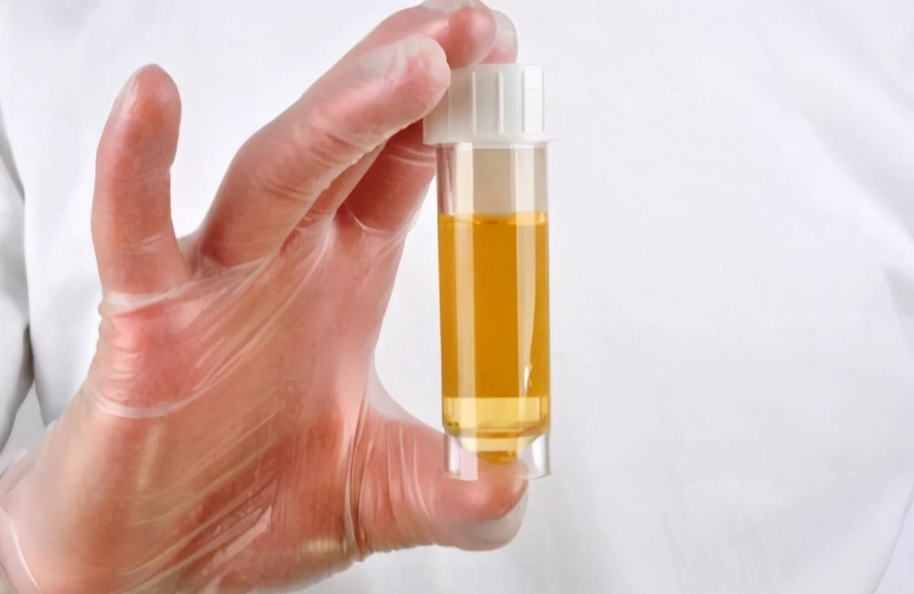 肺出血肾炎综合征是由什么导致的,肺出血肾炎综合征有多罕见