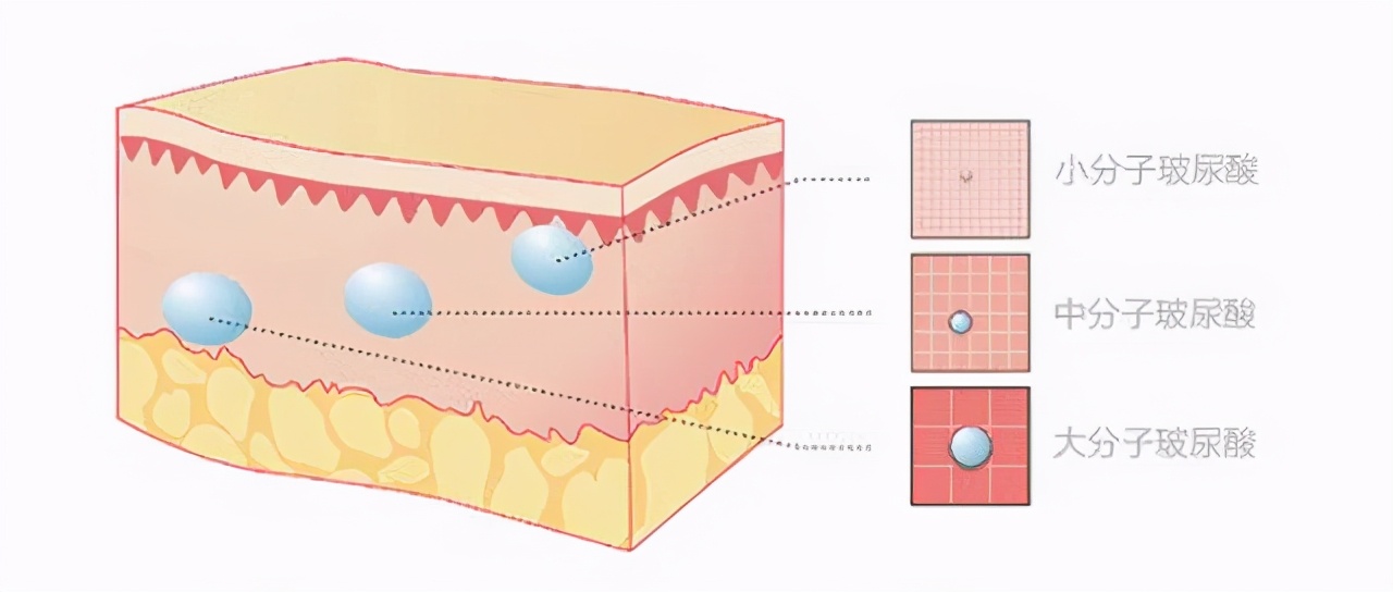 艾尔建旗下玻尿酸有哪些品牌,可以喝的玻尿酸是什么品牌