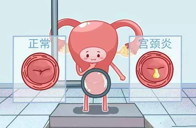 夏天妇科病高发原因,妇科疾病高发期是什么时候