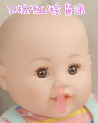 不是感冒一直流鼻涕鼻塞怎么解决,成人不是感冒时不时流鼻涕怎么办