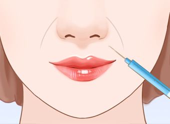 瘦脸针讲解视频,瘦脸针的原理与作用安全有效