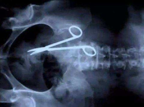 不作死就不会死，看看这些被人类搞进身体里的异物