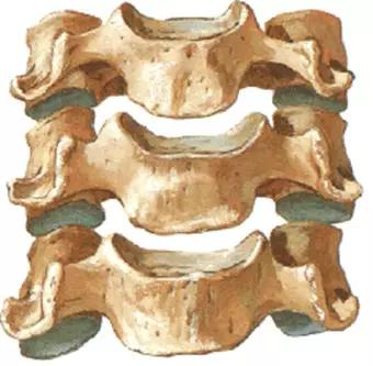 颈椎腰椎疾病ct及mri诊断,腰椎ct可以发现肠部病变吗