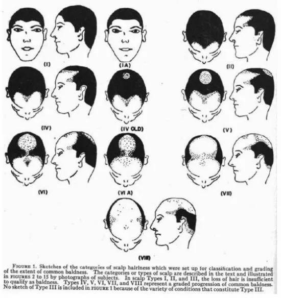 我秃了也变强了真实吗,我秃了也变强了出自哪部动漫